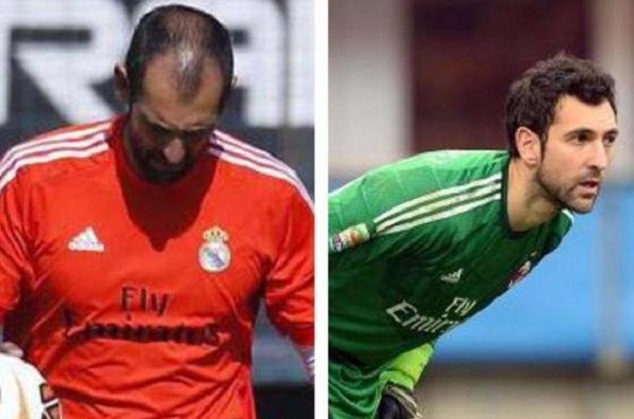 Diego Lopez's hairline before and after